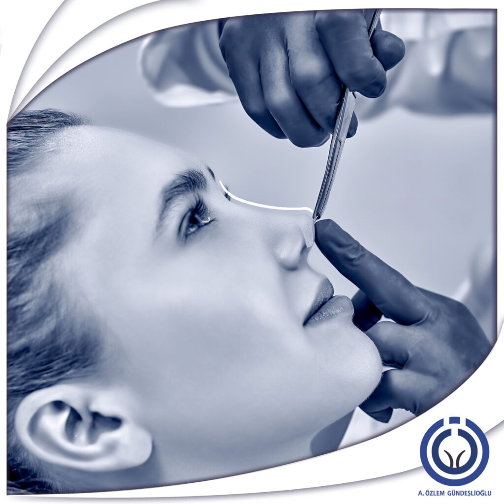 ESTETİK BURUN OPERASYONU (RİNOPLASTİ)